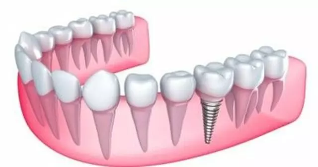 Apple Family Dentistry