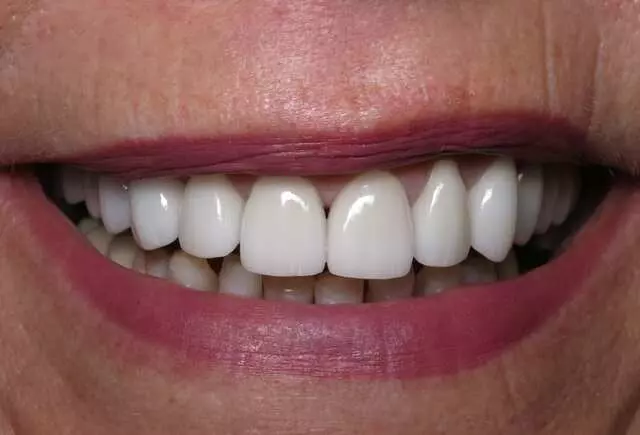 Active Dental