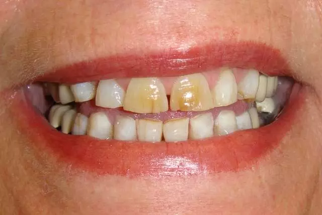 Active Dental